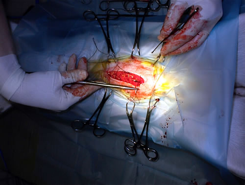 Faciliteiten chirurgie OVH operatiehechten spier